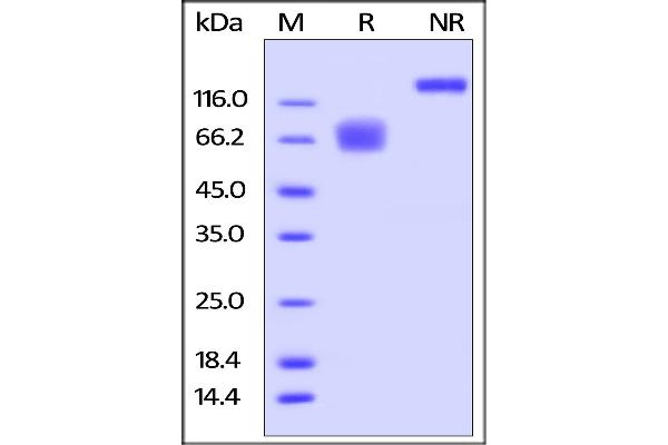 CD58 Protein (CD58) (AA 29-215) (Fc Tag)