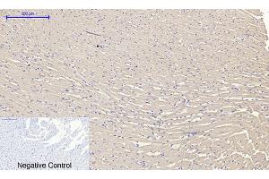Immunohistochemical analysis of paraffin-embedded rat heart tissue. (RANKL 抗体  (AA 10-90))