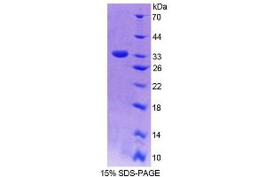 SDS-PAGE analysis of Rat NQO1 Protein. (NQO1 蛋白)