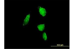 Immunofluorescence of purified MaxPab antibody to PSMA6 on HeLa cell. (PSMA6 抗体  (AA 1-246))