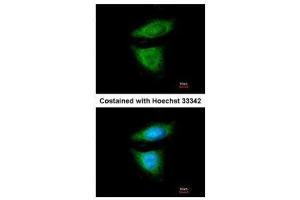 ICC/IF Image Immunofluorescence analysis of methanol-fixed HeLa, using DYNC1I2, antibody at 1:200 dilution. (DYNC1I2 抗体)