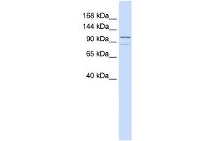 ADCY6 antibody used at 1 ug/ml to detect target protein. (ADCY6 抗体  (C-Term))