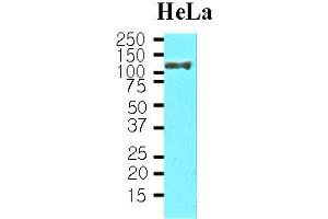Western blot analysis: Cell lysates of HeLa(30ug) were resolved by SDS-PAGE, transferred to NC membrane and probed with anti-human HSP105 ? (HSPH1 抗体)