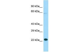 WB Suggested Anti-MOSPD1 Antibody Titration: 1. (MOSPD1 抗体  (N-Term))