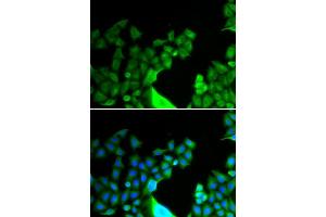 Immunofluorescence analysis of HeLa cells using BCL2L14 antibody (ABIN5973873). (BCL2L14 抗体)