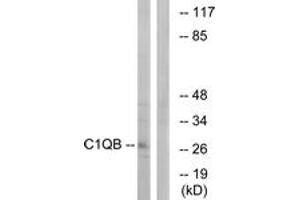 Western Blotting (WB) image for anti-Complement Component 1, Q Subcomponent, B Chain (C1QB) (AA 161-210) antibody (ABIN1534791)