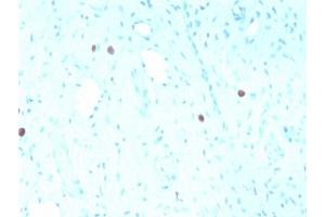 anti-Human Papilloma Virus 16 Capsid Protein (HPV-16 L1) antibody