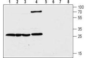 Western blot analysis of human colorectal adenocarcinoma HT-29 (lanes 1 and 5), transplantable human carcinoma cell line T-84 (lanes 2 and 6), human pancreatic carcinoma PANC-1 (lanes 3 and 7) and rat kidney (lanes 4 and 8) lysates: - 1-4. (CLIC1 抗体  (C-Term, Intracellular))