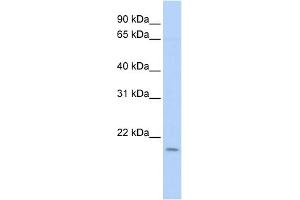 WB Suggested Anti-POLE3 Antibody Titration: 0. (POLE3 抗体  (N-Term))