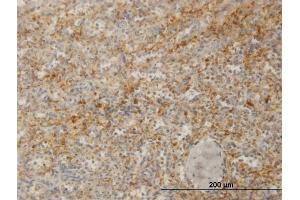 Immunoperoxidase of monoclonal antibody to ZYX on formalin-fixed paraffin-embedded human spleen. (ZYX 抗体  (AA 1-572))
