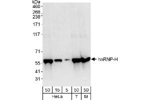 Western Blotting (WB) image for anti-Heterogeneous Nuclear Ribonucleoprotein H1 (H) (HNRNPH1) (C-Term) antibody (ABIN7454640)