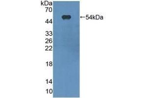 Western Blotting (WB) image for anti-Integrin, alpha X (Complement Component 3 Receptor 4 Subunit) (ITGAX) (AA 907-1115) antibody (ABIN7443875)
