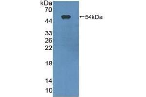 Detection of Recombinant ITGaX, Mouse using Polyclonal Antibody to Integrin Alpha X (CD11c) (CD11c 抗体  (AA 907-1115))