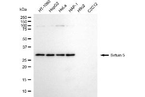 Western blotting analysis using sirtuin 5 antibody (ABIN7800355). (SIRT5 抗体)