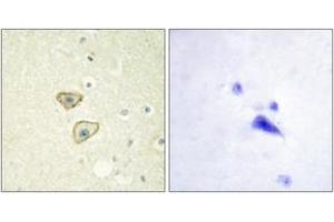 Immunohistochemistry (IHC) image for anti-Epidermal Growth Factor Receptor (EGFR) (AA 986-1035) antibody (ABIN2888655) (EGFR 抗体  (AA 986-1035))