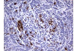 Image no. 1 for anti-Thymidylate Synthetase (TYMS) antibody (ABIN1501589) (TYMS 抗体)