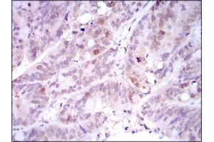 Image no. 1 for anti-Polo-Like Kinase 1 (PLK1) antibody (ABIN1500277) (PLK1 抗体)