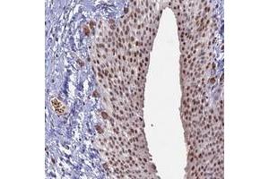 Immunohistochemical staining of human urinary bladder with MFAP1 polyclonal antibody  shows moderate nuclear positivity in urothelial cells at 1:2500-1:5000 dilution. (MFAP1 抗体)