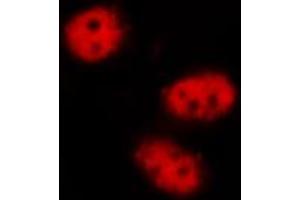 Immunofluorescence (fixed cells) (IF/ICC) image for anti-Signal Transducer and Activator of Transcription 3 (Acute-Phase Response Factor) (STAT3) (pTyr705) antibody (ABIN6255995)