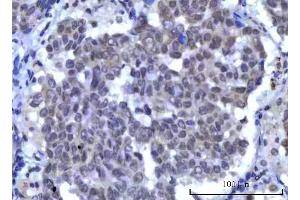 IHC analysis of RBM15B using anti-RBM15B antibody (ABIN7600219). (RBM15B 抗体  (AA 164-890))
