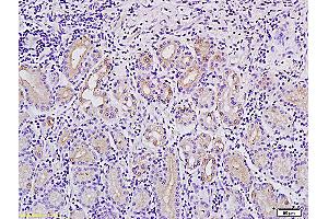 Formalin-fixed and paraffin embedded human stomach tissue labeled with Anti-MACC1Polyclonal Antibody, Unconjugated (ABIN706526) followed by conjugation to the secondary antibody and DAB staining (MACC1 抗体  (AA 761-852))