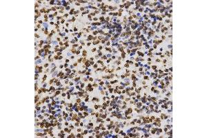 Immunohistochemistry of paraffin-embedded human kidney tissue using H3K27me2 antibody at dilution of 1:200 (x400 lens). (Histone 3 抗体  (H3K27me))