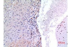 Immunohistochemistry (IHC) analysis of paraffin-embedded Mouse Heart, antibody was diluted at 1:100. (VEGFC 抗体  (Internal Region))