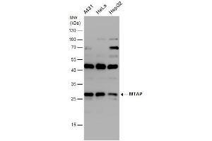 WB Image MTAP antibody detects MTAP protein by western blot analysis. (MTAP 抗体)