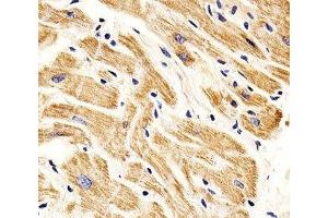 IHC analysis of FFPE human heart section using SMAD1 antibody; Ab was diluted at 1:25. (SMAD1 抗体  (AA 163-196))