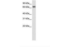 Image no. 1 for anti-Zinc Finger Protein 64 (ZFP64) (N-Term) antibody (ABIN203231) (ZFP64 抗体  (N-Term))