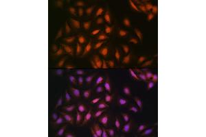 Immunofluorescence analysis of U-2 OS cells using DISC1 Rabbit mAb (ABIN7266799) at dilution of 1:100 (40x lens).