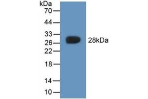Detection of Recombinant CYGB, Rat using Polyclonal Antibody to Cytoglobin (CYGB) (CYGB 抗体  (AA 1-190))