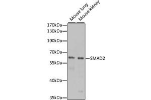 Western blot analysis of extracts of various cell lines, using SMAD2 antibody (ABIN4905224) at 1:1000 dilution. (SMAD2 抗体)