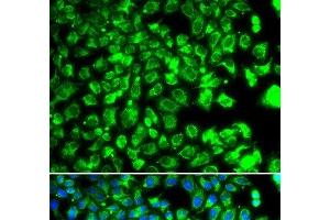 Immunofluorescence analysis of MCF-7 cells using C10orf32 Polyclonal Antibody (C10ORF32 抗体)