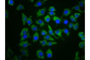 Immunofluorescence staining of A549 cells with ABIN7148438 at 1:66, counter-stained with DAPI. (PDE6C 抗体  (AA 285-451))