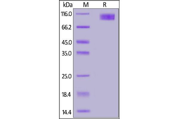 IL17RC Protein (AA 21-465) (Fc Tag)