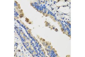 Immunohistochemistry of paraffin-embedded mouse lung using IL36G antibody (ABIN5974550) at dilution of 1/100 (40x lens). (IL1F9 抗体)