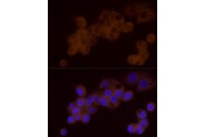 Immunofluorescence analysis of HepG2 cells using DTYMK Rabbit mAb (ABIN7266735) at dilution of 1:25 (40x lens). (DTYMK 抗体)
