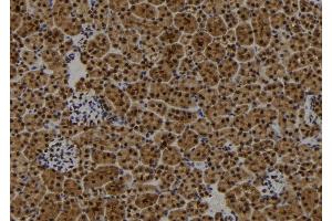 ABIN6272866 at 1/100 staining Mouse kidney tissue by IHC-P. (FIP200 抗体)