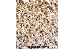 Immunohistochemistry (Paraffin-embedded Sections) (IHC (p)) image for anti-Protein tyrosine Phosphatase, Non-Receptor Type 11 (PTPN11) (AA 526-551) antibody (ABIN6243732)