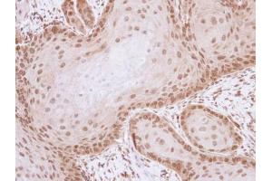 IHC-P Image Immunohistochemical analysis of paraffin-embedded Cal27 xenograft , using ML-IAP, antibody at 1:100 dilution. (BIRC7 抗体)