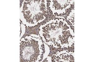 Immunohistochemical analysis of B on paraffin-embedded Mouse testis tissue. (LATS2 抗体  (C-Term))