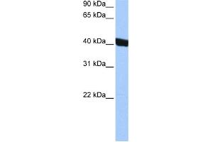 WB Suggested Anti-CHI3L1 Antibody Titration: 0. (CHI3L1 抗体  (Middle Region))