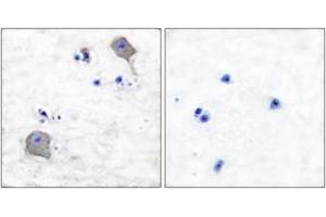 Immunohistochemistry analysis of paraffin-embedded human brain tissue, using Claudin 5 Antibody. (Claudin 5 抗体  (AA 169-218))