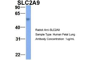 Host:  Rabbit  Target Name:  SLC2A9  Sample Type:  Human Fetal Lung  Antibody Dilution:  1. (SLC2A9 抗体  (Middle Region))