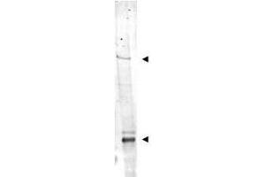 Western blot using  Affinity Purified anti-IDN3 antibody shows detection of bands at ~315 kDa and ~125 kDa corresponding to isoforms of IDN3 (arrow-heads) in mouse heart whole cell tissue extract. (NIPBL 抗体  (AA 330-365))