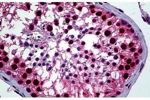 Human Testis: Formalin-Fixed, Paraffin-Embedded (FFPE) (YY1 抗体  (AA 221-321))