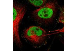 Immunofluorescent staining of U-251 MG with FOSL2 polyclonal antibody  (Green) shows positivity in nucleus but excluded from the nucleoli. (FOSL2 抗体)