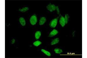 Immunofluorescence of purified MaxPab antibody to KIAA0261 on HeLa cell. (WAPAL 抗体  (AA 1-402))