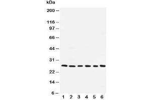 Western blot testing of ARC antibody and human samples 1:  SMMC-7721;  2: A549;  3: U87;  4: HeLa;  5: MCF-7;  6: rat liver (NOL3 抗体  (AA 91-106))